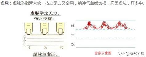 脈細數|【脈象學說】十二種常見脈象簡述